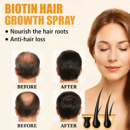 （🔥LAST DAY SALE-50% OFF)  Lovilds™ Biotin Premium Hair Growth Serum✨