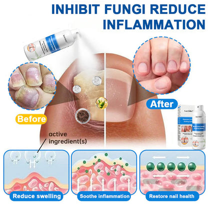 ✅ Official Store: Lovilds® Magnesium Herbal Psoriasis Spray ⚕ FDA Certified (Relieves psoriasis and eczema, improves bacterial infections in the genital area, treats acne and warts, relieves joint pain and neuropathic pain)