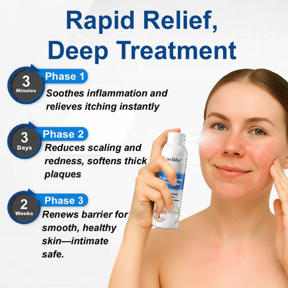 ✅ Official Store: Lovilds® Magnesium Herbal Psoriasis Spray ⚕ FDA Certified (Relieves psoriasis and eczema, improves bacterial infections in the genital area, treats acne and warts, relieves joint pain and neuropathic pain)