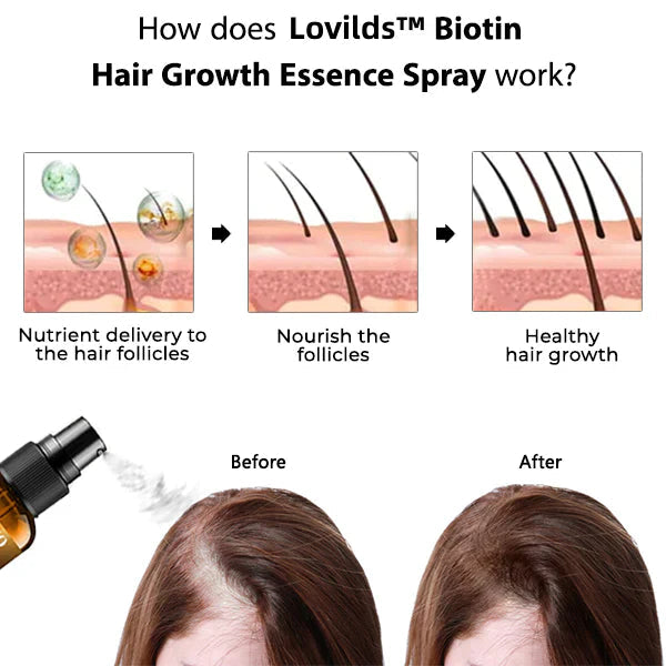 （🔥LAST DAY SALE-50% OFF)  Lovilds™ Biotin Premium Hair Growth Serum✨