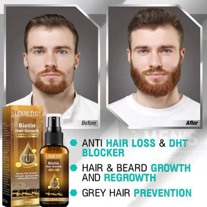 （🔥LAST DAY SALE-50% OFF)  Lovilds™ Biotin Premium Hair Growth Serum✨